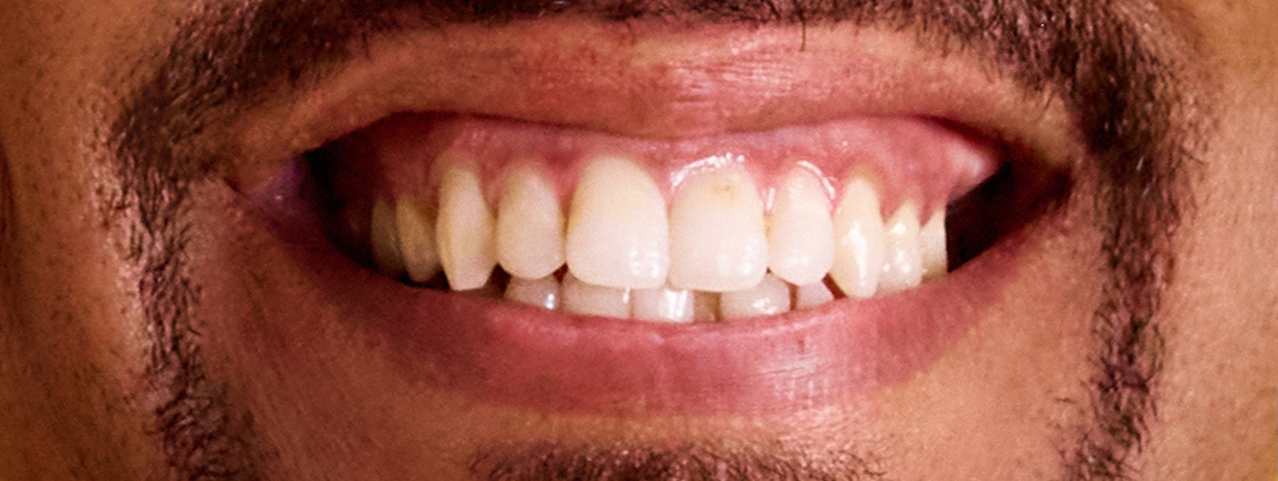 smile-sample-1 smile-sample-1