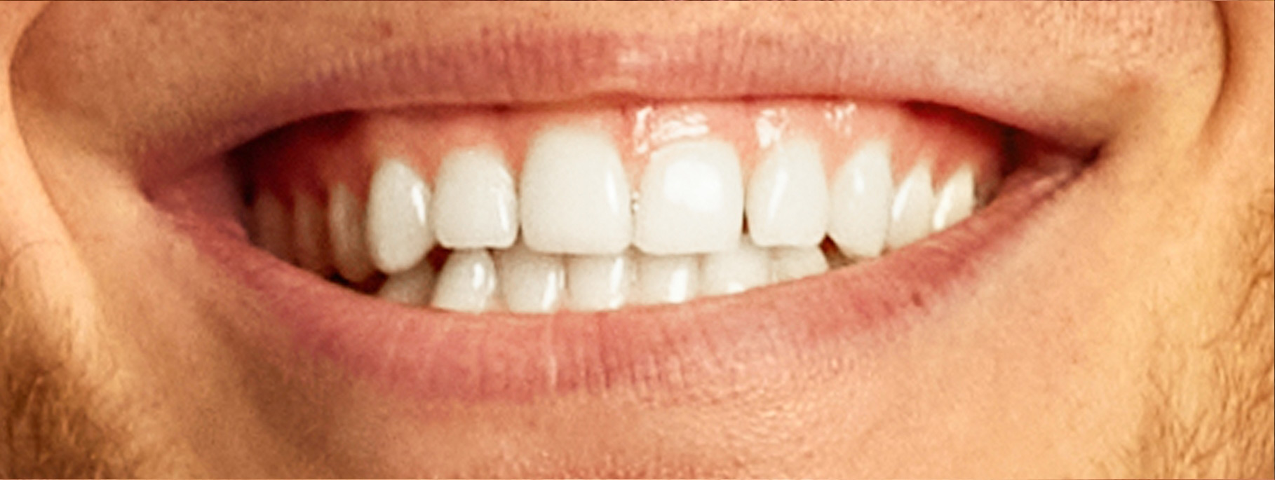 smile-sample-2 smile-sample-2