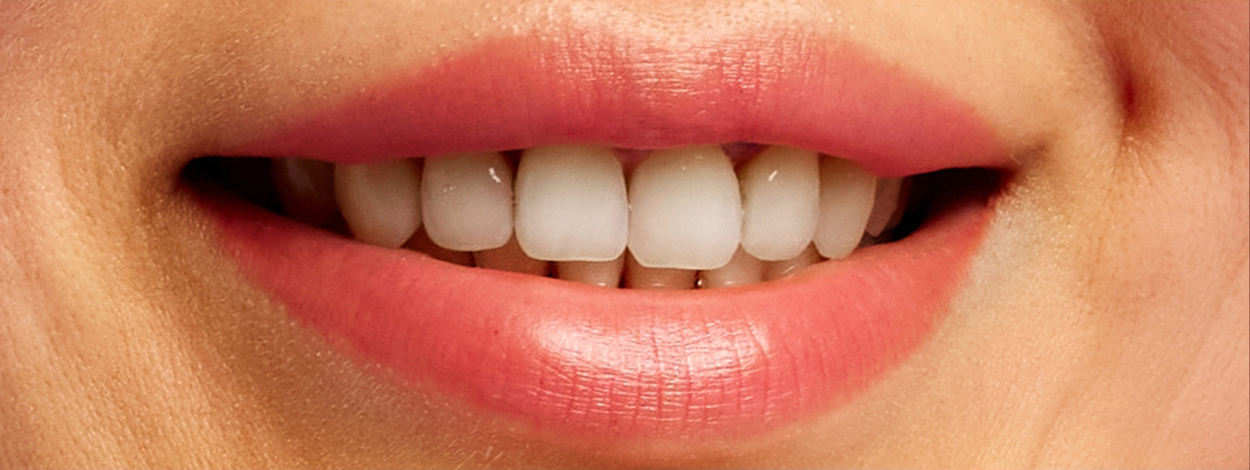 smile-sample-3 smile-sample-3