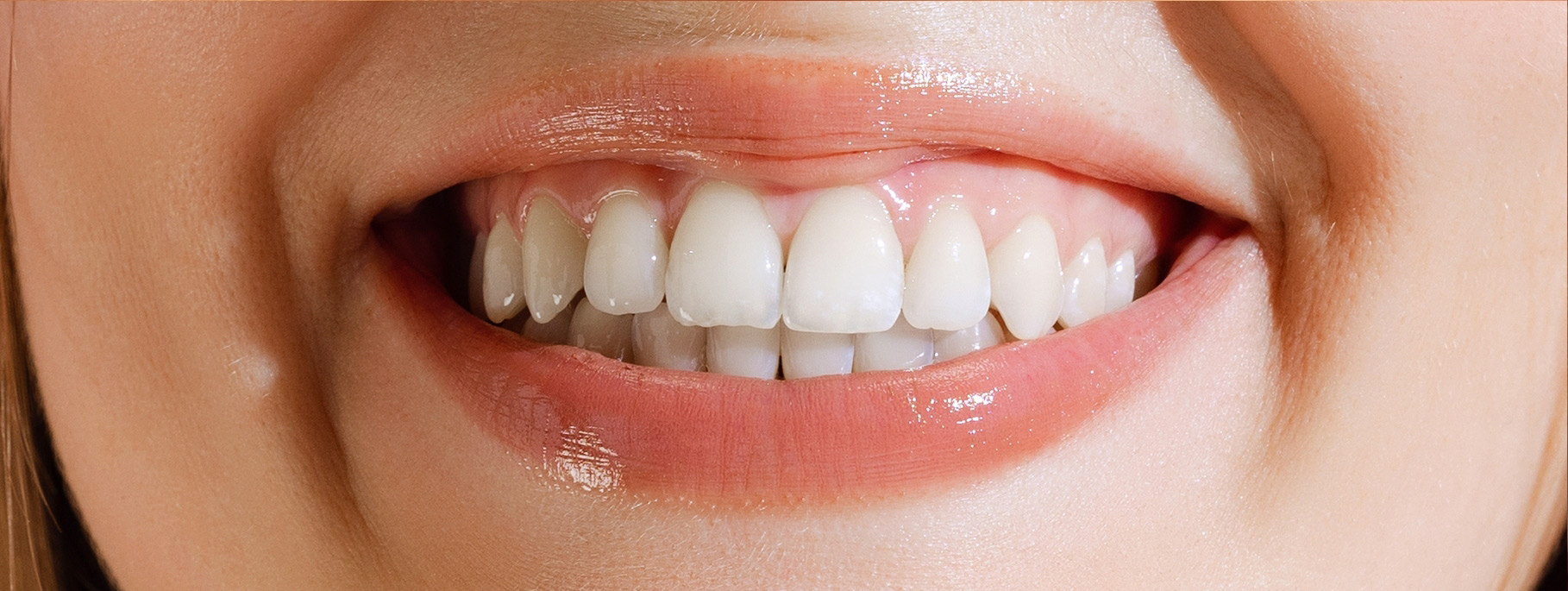 smile-sample-4 smile-sample-4