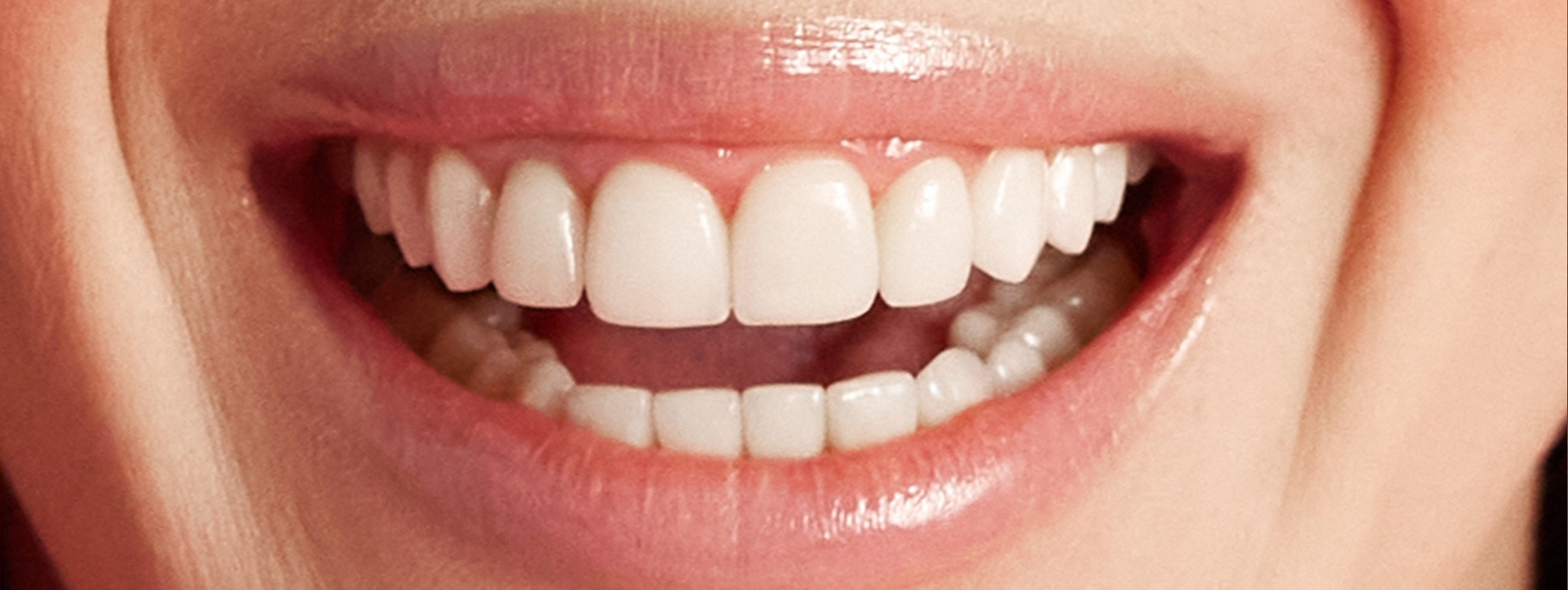 smile-sample-5 smile-sample-5
