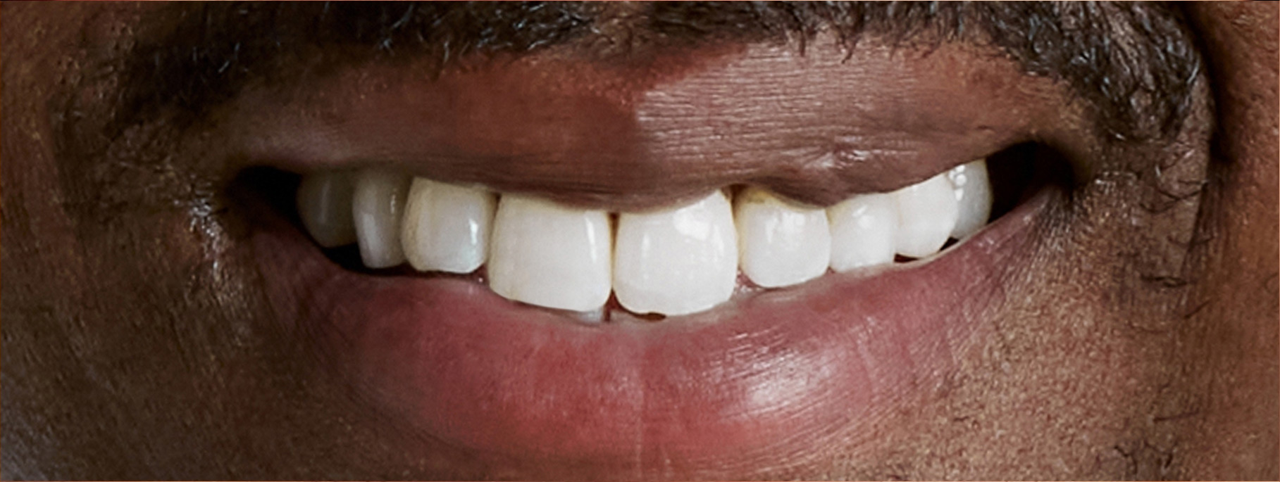 smile-sample-6 smile-sample-6