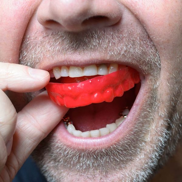 bite-guard-for-bruxism